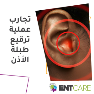 تجارب عملية ترقيع طبلة الأذن